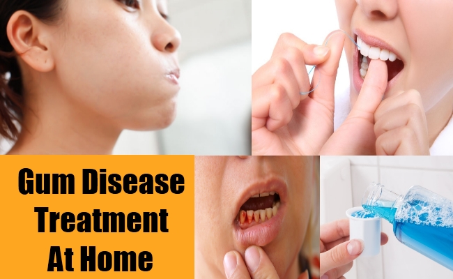 Gum Infections