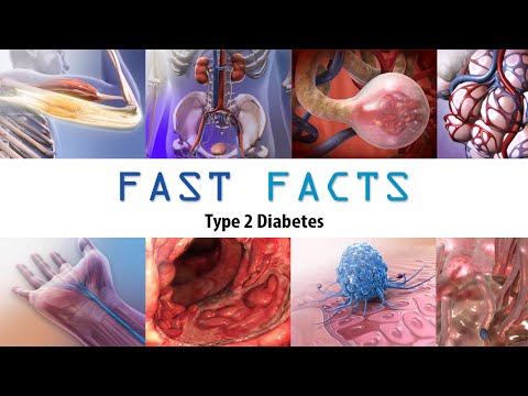 Type 2 Diabetes mellitus