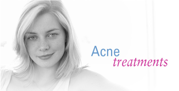 adult acne treatment