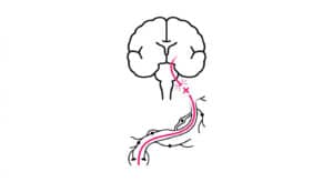 Diagram showing how the varicella-zoster virus may affect brain inflammation pathways
