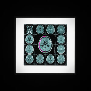 Intermittent fasting and brain health concept showing the gut-brain connection