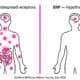 Comparison diagram showing Ozempic side effects from widespread GLP-1 receptor activation vs targeted BRP hypothalamus action from Stanford 2026 Nature study.