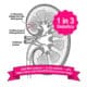 Diagram showing diabetic kidney disease stages by eGFR and albuminuria level with 2026 ERA Congress finding that DCCB blood pressure drugs raise kidney risk by 33%.