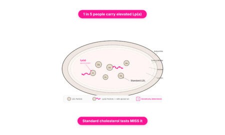 Infographic explaining lipoprotein(a) risk levels, 2026 NIH study results showing 31% higher stroke risk at Lp(a) ≥175 nmol/L, and who should get tested."
