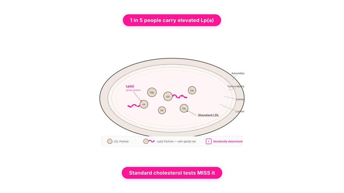 Infographic explaining lipoprotein(a) risk levels, 2026 NIH study results showing 31% higher stroke risk at Lp(a) ≥175 nmol/L, and who should get tested."