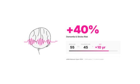 Diagram showing signs of dementia decades early through sleep EEG brain age index — 40% higher risk per 10-year brain age gap from UCSF JAMA Network Open 2026 study.