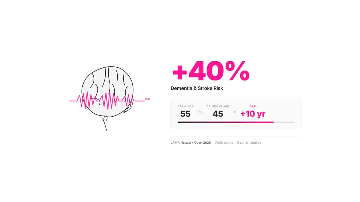 Diagram showing signs of dementia decades early through sleep EEG brain age index — 40% higher risk per 10-year brain age gap from UCSF JAMA Network Open 2026 study.