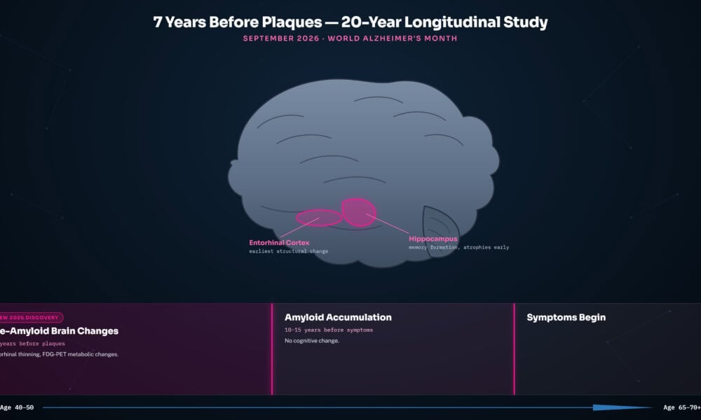 Timeline showing early signs of Alzheimer's disease appearing 7 years before amyloid plaques and 10-15 years before symptoms from September 2026 longitudinal brain imaging study.