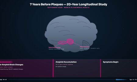 Timeline showing early signs of Alzheimer's disease appearing 7 years before amyloid plaques and 10-15 years before symptoms from September 2026 longitudinal brain imaging study.
